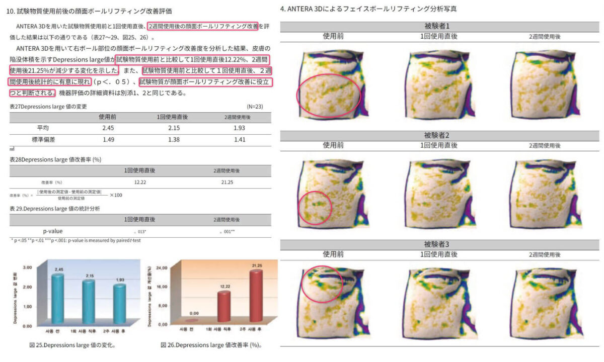 頬シワ