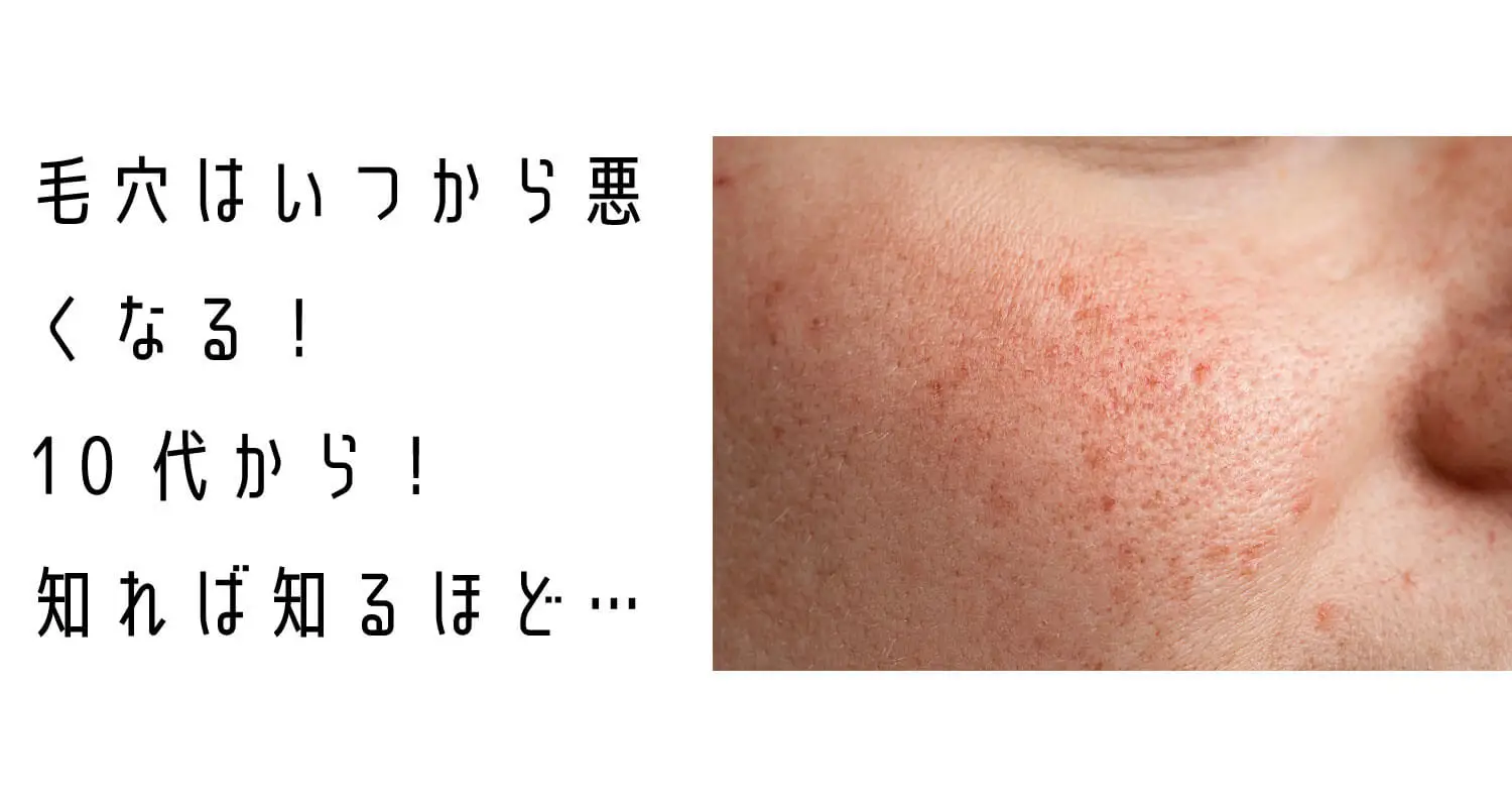 あなたが現在見ているのは AAA美容法アップデート❗毛穴トラブルの正体❗