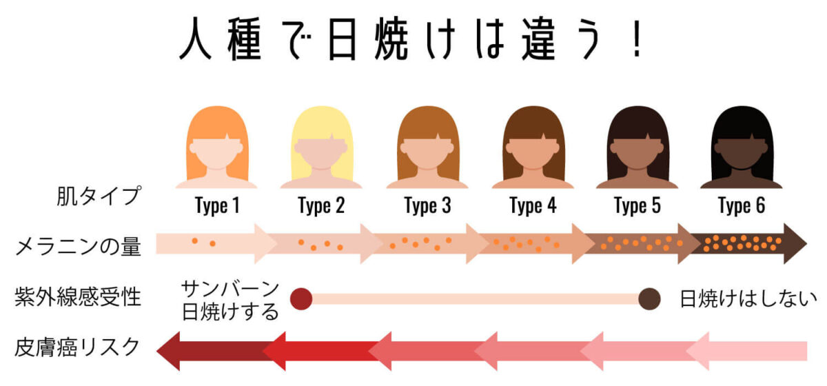 人種別日焼け