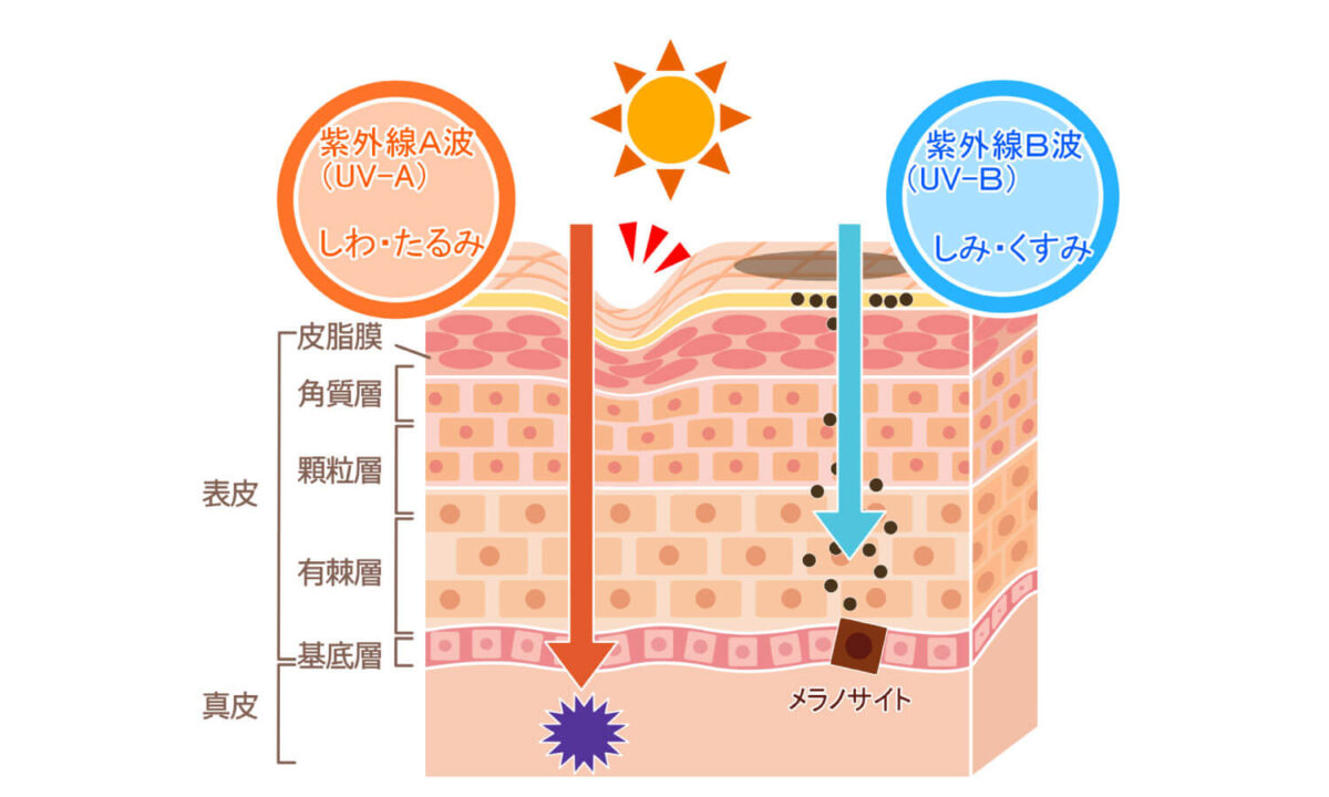 UVトラブル