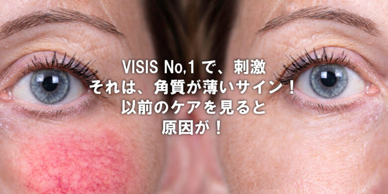 角質の薄さが刺激に