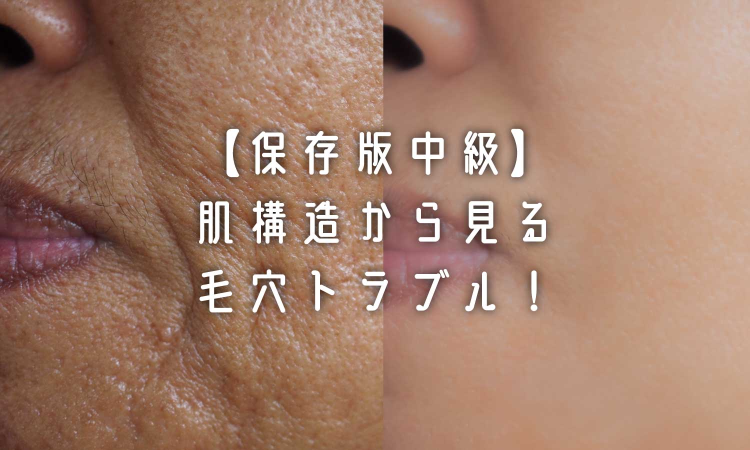 あなたが現在見ているのは 【保存版中級】肌構造から見る毛穴トラブル❗