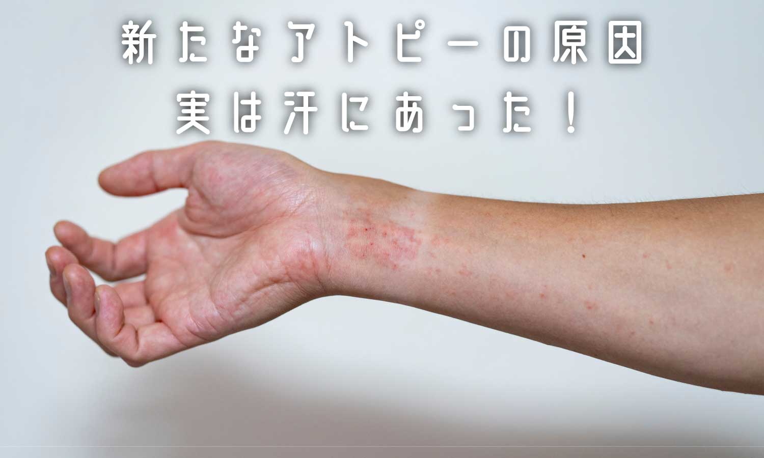 あなたが現在見ているのは アトピー、原因の一つまた発見❗